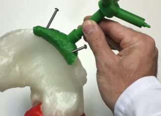 El Hospital Gregorio Marañón se sitúa a la vanguardia de la impresión en 3D