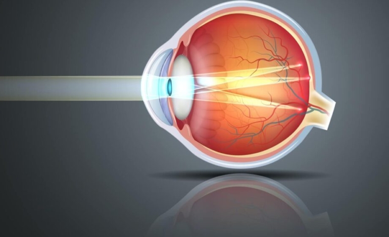 ¿que-es-el-astigmatismo?
