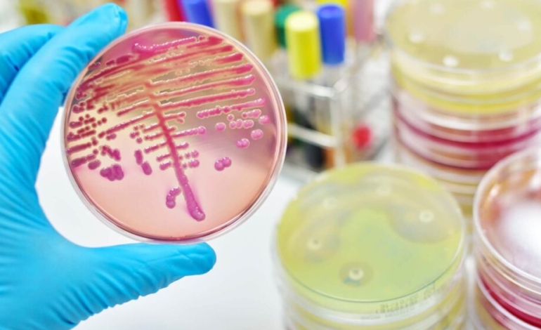 crear-bacterias-intestinales-que-desarrollan-probioticos-para-proteger-nuestra-salud