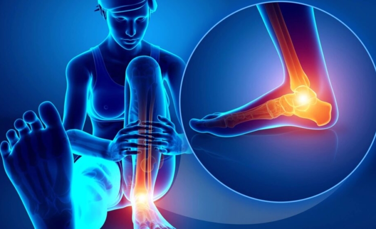 artrosis-de-tobillo-y-tratamiento-mediante-artroplastia