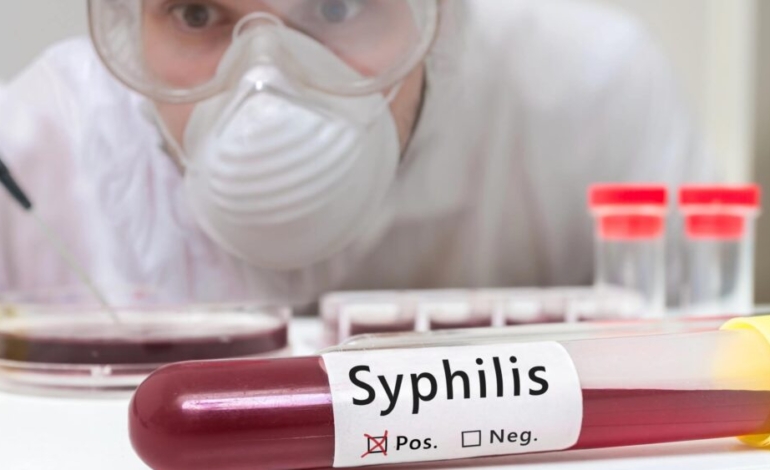america-registra-la-mayor-incidencia-mundial-de-sifilis
