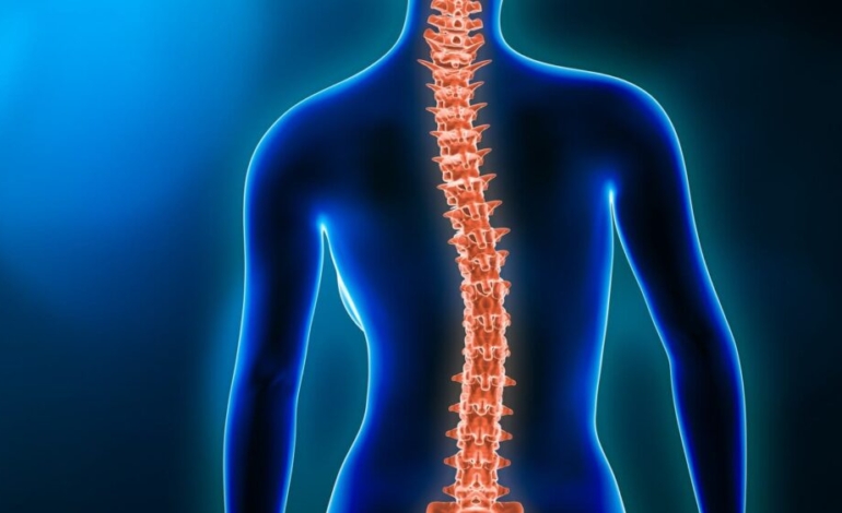 diagnostico-y-tratamiento-de-la-escoliosis