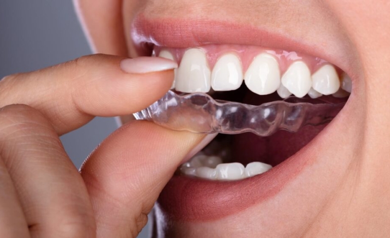 la-importancia-de-tu-salud-bucodental-mas-alla-de-la-estetica