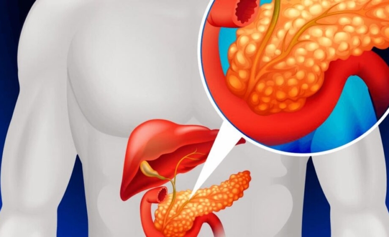 ¡asi-se-mueven-las-celulas-tumorales-durante-una-cirugia-de-cancer-de-pancreas!