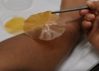 Apósitos que se activan con luz solar y frenan las infecciones bacterianas