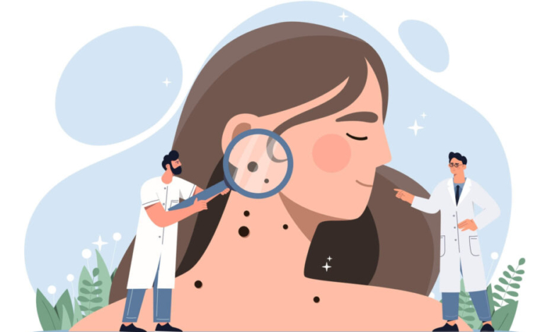 asi-combate-la-inmunoterapia-el-cancer-de-piel