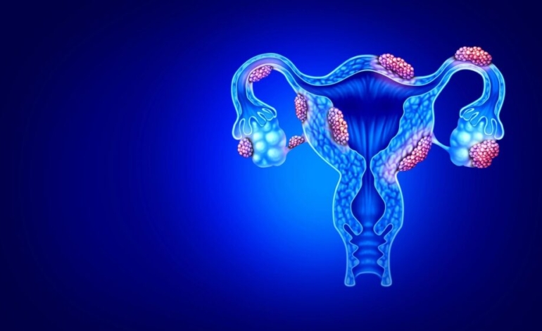 la-importancia-de-abordar-el-dolor-menstrual-incapacitante