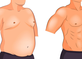 Ginecomastia e impacto en la autoestima y la salud de los hombres