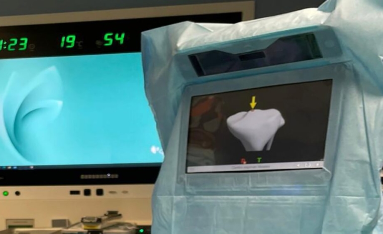 asi-es-la-innovadora-cirugia-de-protesis-de-rodilla-navegada