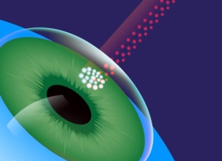 ¡Adiós a las dudas y mitos sobre la cirugía láser de la vista!