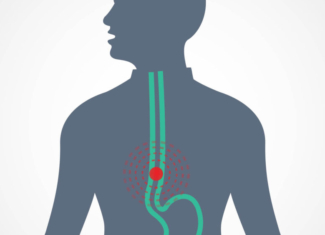 Tecnología y especialización en el tratamiento del cáncer de esófago