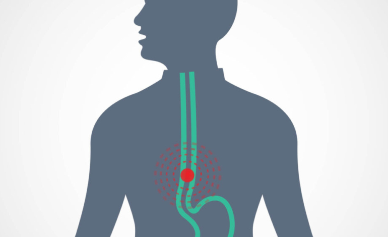 tecnologia-y-especializacion-en-el-tratamiento-del-cancer-de-esofago