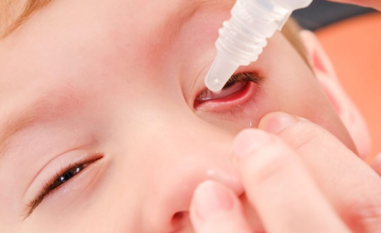 consejos-utiles-para-poner-colirio-en-los-ojos-a-ninos-pequenos