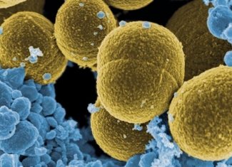 ¿Por qué las bacterias más «pegajosas» causan infecciones menos graves?