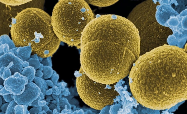 ¿por-que-las-bacterias-mas-«pegajosas»-causan-infecciones-menos-graves?