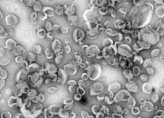 Nanovehículos sintéticos que aumentan la respuesta inmunitaria ante los patógenos
