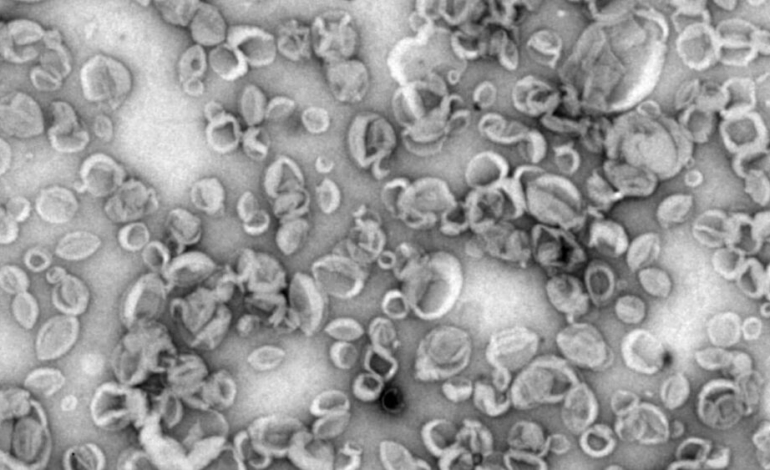nanovehiculos-sinteticos-que-aumentan-la-respuesta-inmunitaria-ante-los-patogenos