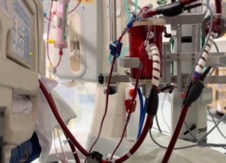 Tecnología única en el mundo para dar soporte a corazón y pulmones en pacientes en situación crítica