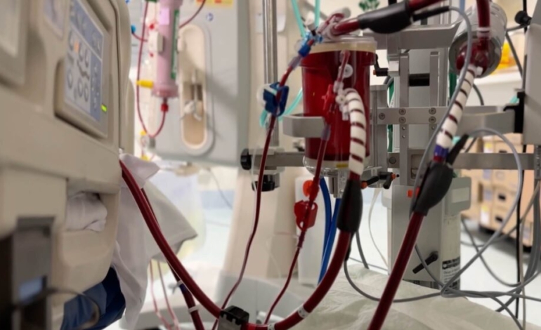 tecnologia-unica-en-el-mundo-para-dar-soporte-a-corazon-y-pulmones-en-pacientes-en-situacion-critica